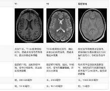 米兰真人-T1逆转TSM,Bwipo高光表现